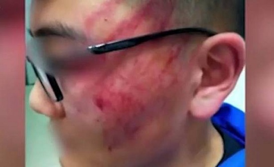 بالفيديو: 12 صفعة من الاستاذ.. أصابت التلميذ بارتجاج دماغي! بالفيديو: 12 صفعة من الاستاذ.. أصابت التلميذ بارتجاج دماغي!