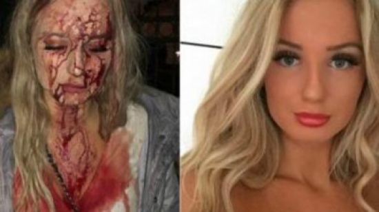 صور مروعة.. رفضت التحرش فهشم وجهها 'الفاتن' وأدماه صور مروعة.. رفضت التحرش فهشم وجهها 'الفاتن' وأدماه
