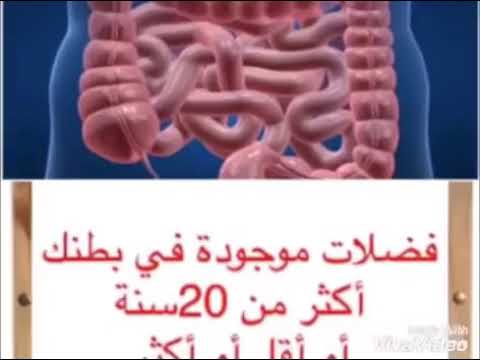 مشروب تنظيف القولون ستخرج منك فضلات صلبة كالأحجار " فيديو" مشروب تنظيف القولون ستخرج منك فضلات صلبة كالأحجار " فيديو"