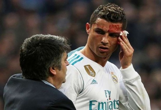 ريال مدريد ينشر فيديو يظهر شدة إصابة رونالدو ريال مدريد ينشر فيديو يظهر شدة إصابة رونالدو