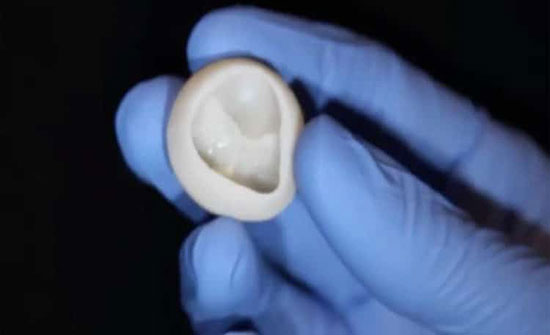 قلب من الكولاجين يفتح باب الأمل لملايين المرضى قلب من الكولاجين يفتح باب الأمل لملايين المرضى