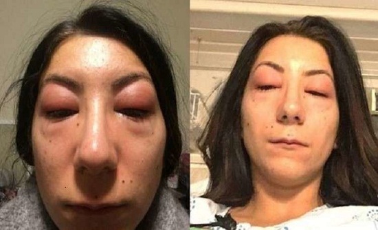 جاءت لتكحّلها فأعمتها.. هذه قصة إيزابيل مع التجميل جاءت لتكحّلها فأعمتها.. هذه قصة إيزابيل مع التجميل