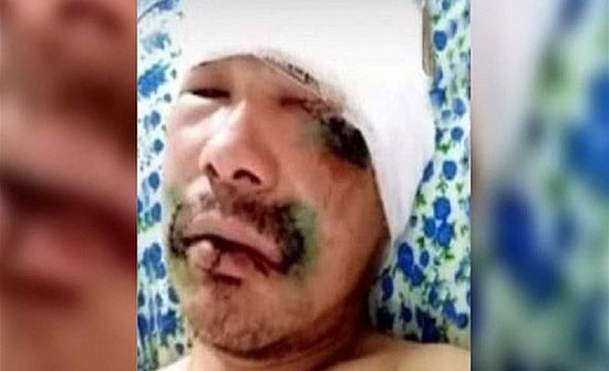 رجلٌ شجاعٌ يقطع لسانَ دبٍّ هاجمه! رجلٌ شجاعٌ يقطع لسانَ دبٍّ هاجمه!