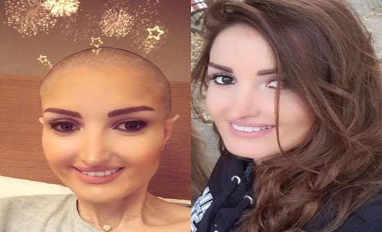 سأهزم السرطان بـNew Look.. قصة ميسا التي شغلت الناس سأهزم السرطان بـNew Look.. قصة ميسا التي شغلت الناس