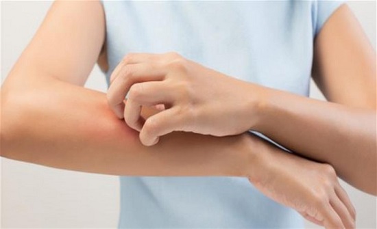 برغوث أم دبور.. كيف تعالج لدغات الحشرات؟ برغوث أم دبور.. كيف تعالج لدغات الحشرات؟