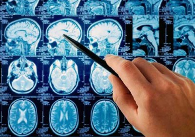 دواء جديد لعلاج سرطان الرأس والعنق أكثر فعالية من الكيماوي دواء جديد لعلاج سرطان الرأس والعنق أكثر فعالية من الكيماوي