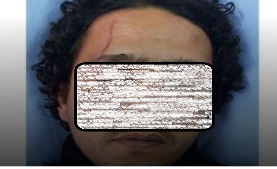 السرطاوي: قوة أمنية وصلت إلى بيوت المعتدين على الشاب في الزرقاء - صور وتفاصيل " رواية الوالد" السرطاوي: قوة أمنية وصلت إلى بيوت المعتدين على الشاب في الزرقاء - صور وتفاصيل " رواية الوالد"