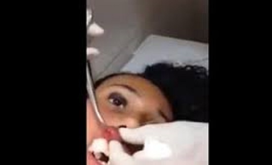 بالفيديو : لقطات صادمة للحظة استخراج دودة عملاقة من شفاه فتاة بالفيديو : لقطات صادمة للحظة استخراج دودة عملاقة من شفاه فتاة