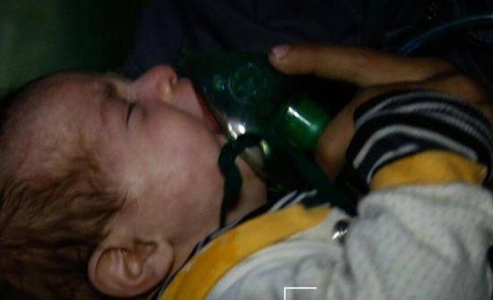 سوريا.. مقتل وجرح 100 شخص في الغوطة الشرقية سوريا.. مقتل وجرح 100 شخص في الغوطة الشرقية