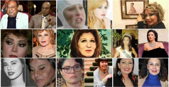 نجوم وقعوا ضحايا «الأخطاء الطبية».. إحداهن لم يعرفها زوجها وأخرى: «ما بقتش أعرف أقفل عيني» نجوم وقعوا ضحايا «الأخطاء الطبية».. إحداهن لم يعرفها زوجها وأخرى: «ما بقتش أعرف أقفل عيني»