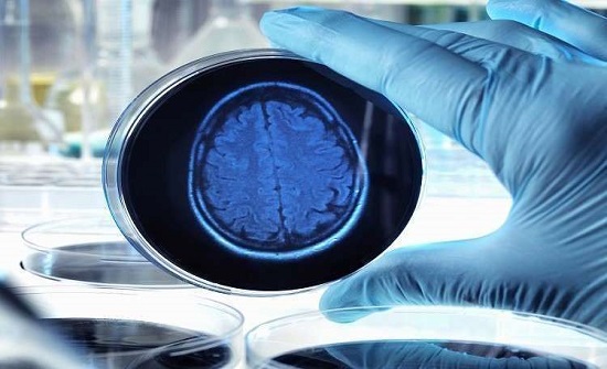 الزهايمر ليس مرضا واحدا بل 6 حالات مختلفة الزهايمر ليس مرضا واحدا بل 6 حالات مختلفة