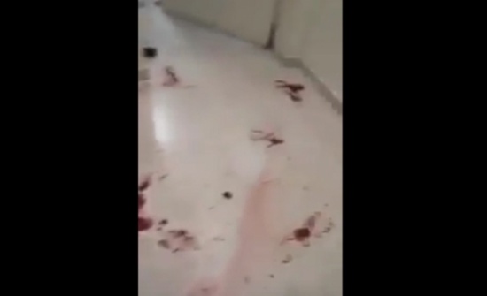 بالفيديو شاهدوا الدماء في اروقة مستشفى الملك عبدالله المؤسس بعد المشاجرة العشائرية بالفيديو شاهدوا الدماء في اروقة مستشفى الملك عبدالله المؤسس بعد المشاجرة العشائرية