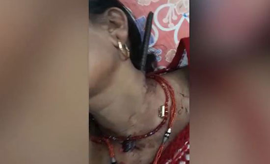 نجاة امرأة بمعجزة بعد اختراق سيخ حديد عنقها (فيديو) نجاة امرأة بمعجزة بعد اختراق سيخ حديد عنقها (فيديو)
