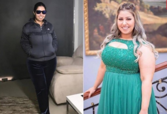 فنانة تتخلص من الوزن الزائد ومن السخرية بعملية نحت الدهون! فنانة تتخلص من الوزن الزائد ومن السخرية بعملية نحت الدهون!