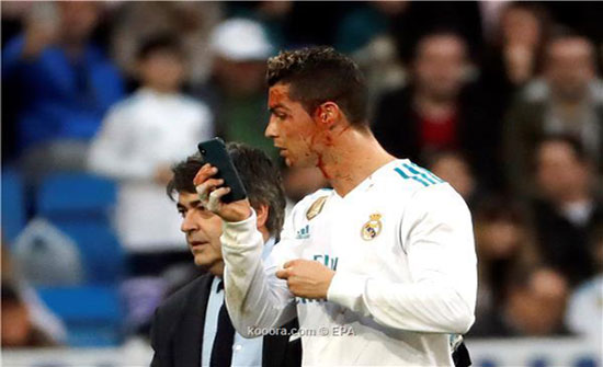بالفيديو والصور : بركان ريال مدريد ينفجر بسباعية أمام ديبورتيفو لاكورونيا بالفيديو والصور : بركان ريال مدريد ينفجر بسباعية أمام ديبورتيفو لاكورونيا