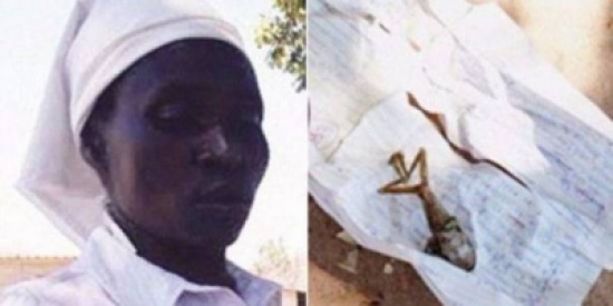 هذه السيدة أنجبت مخلوقاً صادماً وعجيباً! هذه السيدة أنجبت مخلوقاً صادماً وعجيباً!