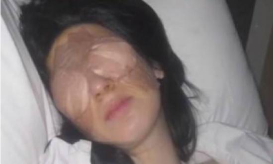مرض نادر وغريب.. عينا هذه المرأة تقفلان 3 أيام متتالية! مرض نادر وغريب.. عينا هذه المرأة تقفلان 3 أيام متتالية!