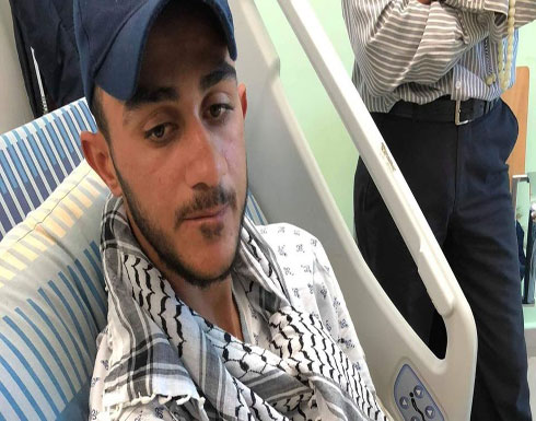 كيف أنقذ هاتف صحفيا فلسطينيا من رصاصة الاحتلال كادت تخترق شريانه (صور) كيف أنقذ هاتف صحفيا فلسطينيا من رصاصة الاحتلال كادت تخترق شريانه (صور)