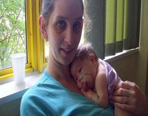 رضيعة تمتلك لساناً يوازي طول وجهها