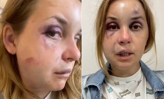 أمام عيني طفلها وعلى متن طائرة .. محاولة اعتداء جسدي على مذيعة شهيرة بأوكرانيا أمام عيني طفلها وعلى متن طائرة .. محاولة اعتداء جسدي على مذيعة شهيرة بأوكرانيا