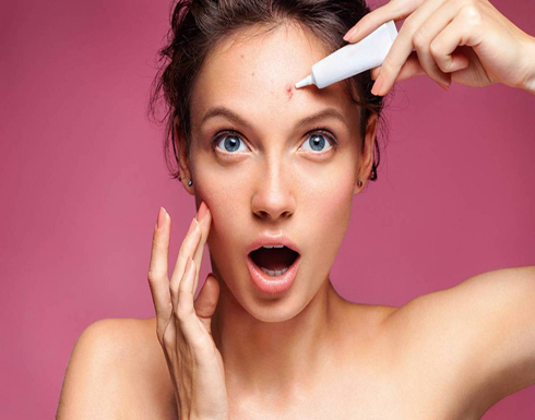 حمض الساليسيليك علاج فعّال لمشكلة حَبّ الشباب حمض الساليسيليك علاج فعّال لمشكلة حَبّ الشباب
