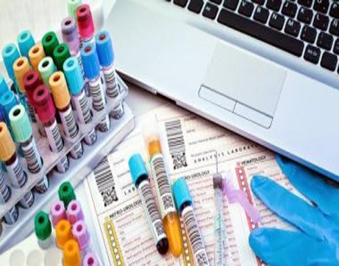 تحليل CMP يقيس 14 مادة بجسمك ويكشف أمراض الكبد والكلى تحليل CMP يقيس 14 مادة بجسمك ويكشف أمراض الكبد والكلى