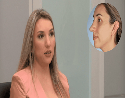 بالفيديو: سيدة أمريكية تتفاجأ بنمو أنفها بعد إجراء جراحة تجميلية لتصغيرها بالفيديو: سيدة أمريكية تتفاجأ بنمو أنفها بعد إجراء جراحة تجميلية لتصغيرها
