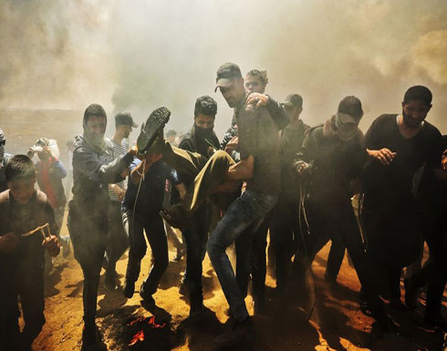 إصابة 115 فلسطينيا برصاص الاحتلال قرب حدود غزة إصابة 115 فلسطينيا برصاص الاحتلال قرب حدود غزة