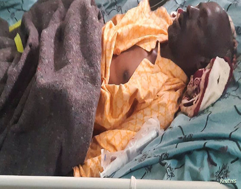 إثيوبيا.. 10 قتلى في غارات جوية على عاصمة إقليم تيغراي إثيوبيا.. 10 قتلى في غارات جوية على عاصمة إقليم تيغراي