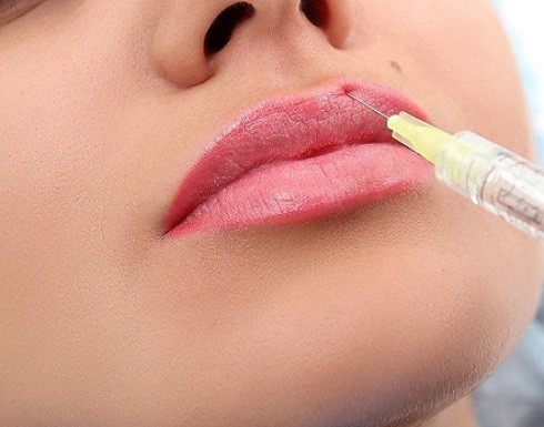 نهاية مأساوية لفتاة أمريكية رغبت في " شفاه " جذابة كالمشاهير نهاية مأساوية لفتاة أمريكية رغبت في " شفاه " جذابة كالمشاهير
