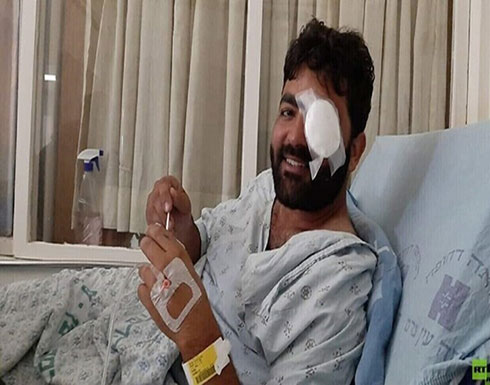بالفيديو .. الصحفي الفلسطيني معاذ عمارنة: الرصاصة لا تزال في رأسي بالفيديو .. الصحفي الفلسطيني معاذ عمارنة: الرصاصة لا تزال في رأسي