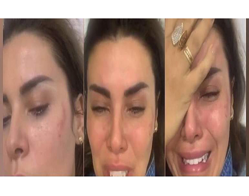 شاهد.. اعتداء وحشي على فنانة شهيرة ونقلها للمستشفى شاهد.. اعتداء وحشي على فنانة شهيرة ونقلها للمستشفى