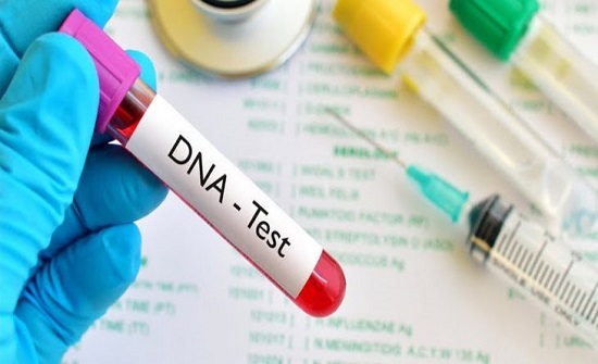 فحص " DNA " للتعرف على الجثة الموجودة في البشير والنتيجة بعد 24 ساعة