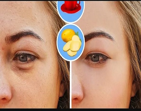 بـ القهوة.. وصفة سريعة لعلاج الهالات السوداء حول العين بـ القهوة.. وصفة سريعة لعلاج الهالات السوداء حول العين
