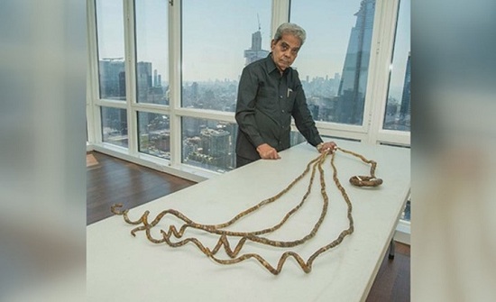 بالفيديو.. رجلٌ يقصُّ أظافره بعدما تركها تنمو لـ 66 سنة! بالفيديو.. رجلٌ يقصُّ أظافره بعدما تركها تنمو لـ 66 سنة!
