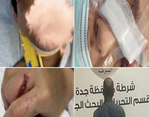 بعد تعنيف ابنتها.. والدة تهدد بالانتحار في هذه الحال بعد تعنيف ابنتها.. والدة تهدد بالانتحار في هذه الحال