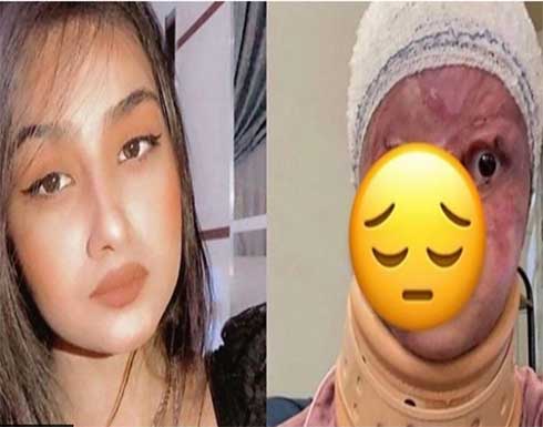 رفضت الزواج منه فشوه جسدها..جريمة "الأميرة مريم" تهز العراق رفضت الزواج منه فشوه جسدها..جريمة "الأميرة مريم" تهز العراق