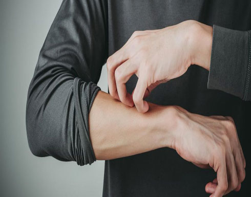 لماذا نشعر بالحكة دون سبب؟ لماذا نشعر بالحكة دون سبب؟
