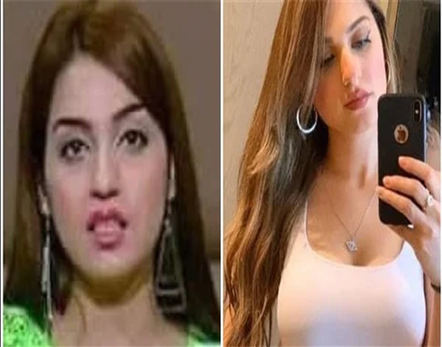 واخدة حقنة عشان تبيض لونها .. صور : فنانة شهيرة تفضح ياسمين عز
