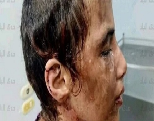 أجبروها على شرب الكلور وتناول أعقاب السجائر.. القصة الكاملة لتعذيب طفلة مصرية أجبروها على شرب الكلور وتناول أعقاب السجائر.. القصة الكاملة لتعذيب طفلة مصرية