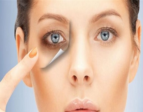 أسباب وعلاج الهالات السوداء أسباب وعلاج الهالات السوداء