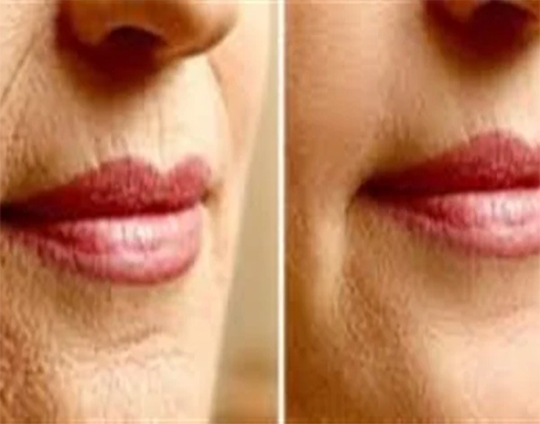ليس فقط السن.. أسباب ظهور تجاعيد الشفاه ليس فقط السن.. أسباب ظهور تجاعيد الشفاه