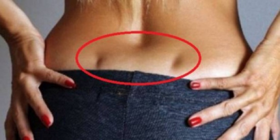 ماذا يعني وجود هذه الغمازات أسفل الظهر؟