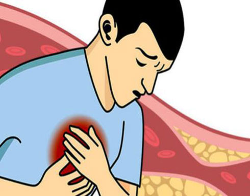 علامات تدل على ارتفاع الكوليسترول دون أن تشعر علامات تدل على ارتفاع الكوليسترول دون أن تشعر
