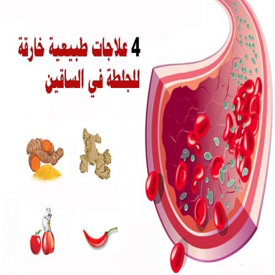 4 علاجات طبيعية خارقة للجلطة في الساقين