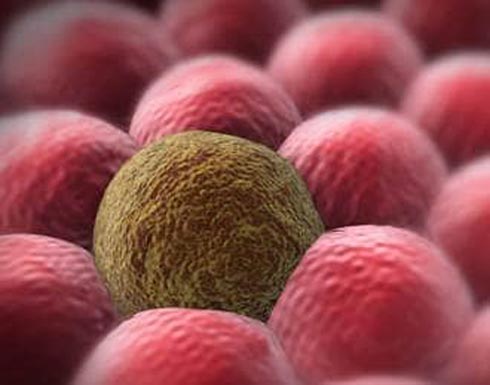 كيف يصاب الإنسان بالسرطان؟