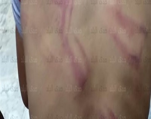 عامل يعذب طفلا بسبب لهوه بطائرة ورقية.. وأمن الغربية في مصر يطارده.. صور عامل يعذب طفلا بسبب لهوه بطائرة ورقية.. وأمن الغربية في مصر يطارده.. صور