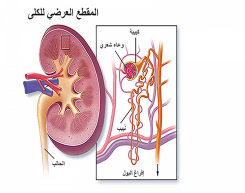 الفشل الكلوي الحاد.. قد يكون مُميتاً