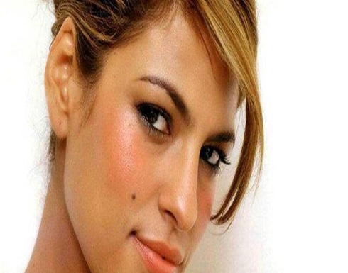 ليست كل "شامة" هي سرطانيّة.. ولكن كيف نميّز؟