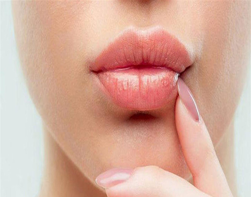 ثمان علامات في الشفاه تنذرك بالإصابة بمشكلات صحية خطيرة ثمان علامات في الشفاه تنذرك بالإصابة بمشكلات صحية خطيرة